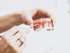 Cleaning dentures from orthodontist