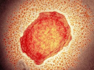 Monkeypox virus